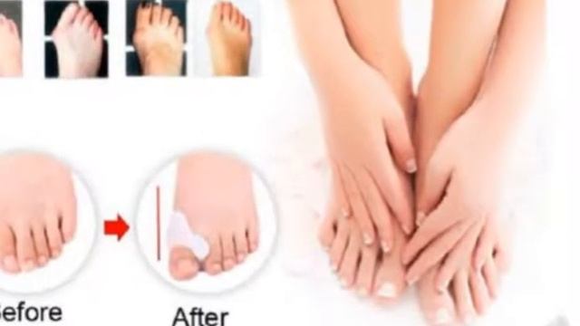Valgus Pro Отзывы смотреть онлайн