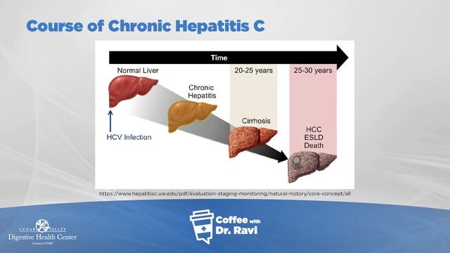 Coffee with Dr. Ravi #46: Chronic Hepatitis C смотреть онлайн