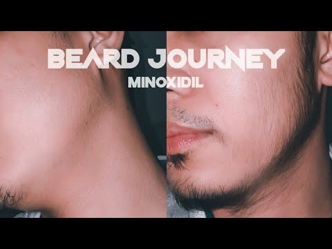 Filipino Minoxidil Beard Journey | Week 0 - Slow Gainer's Journey (Bad Genes) смотреть онлайн
