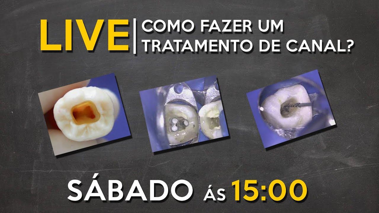 LIVE #009 - Como fazer um tratamento endodôntico? смотреть онлайн