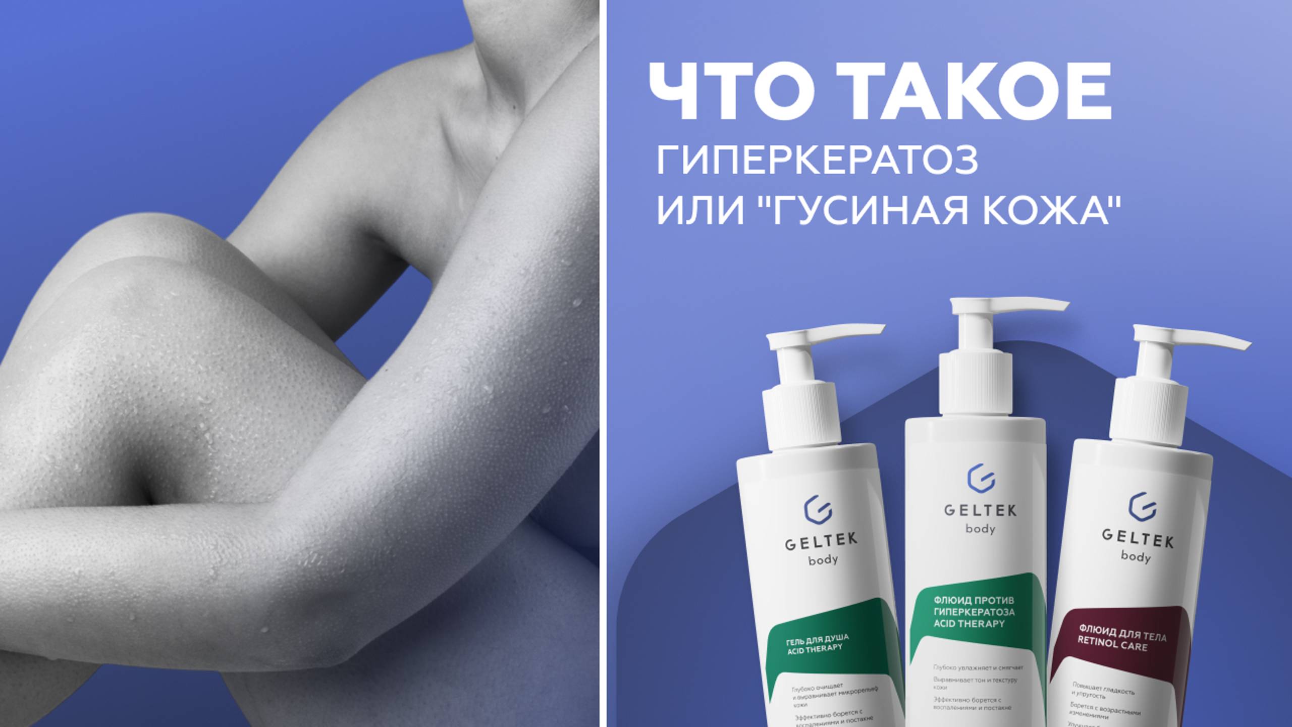 Что такое гиперкератоз или "гусиная кожа" смотреть онлайн