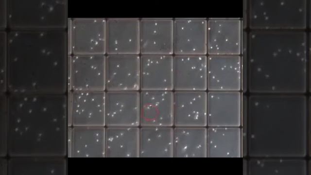 Erkak Urug'ini Makler Kamerasi Yordamida Tekshirish