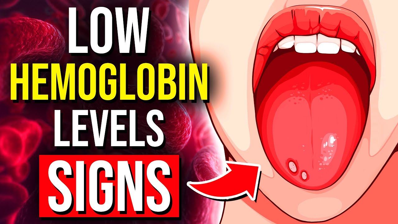 9 Alarming Signs Of Low Hemoglobin You CANNOT Ignore смотреть онлайн