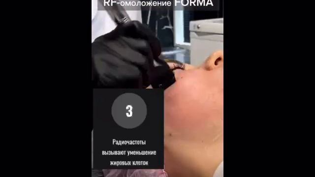 Inmode смотреть онлайн