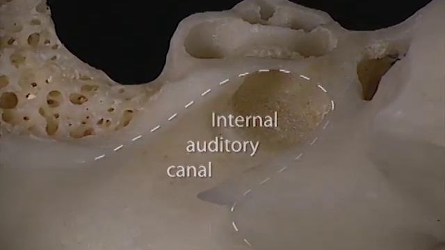 Acland's Video Atlas of Human Anatomy: Cochlea смотреть онлайн