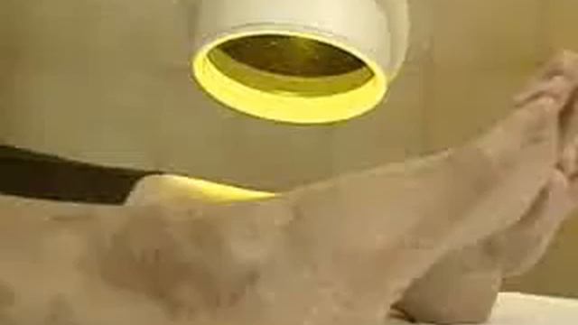 Bioptron healing light therapy смотреть онлайн