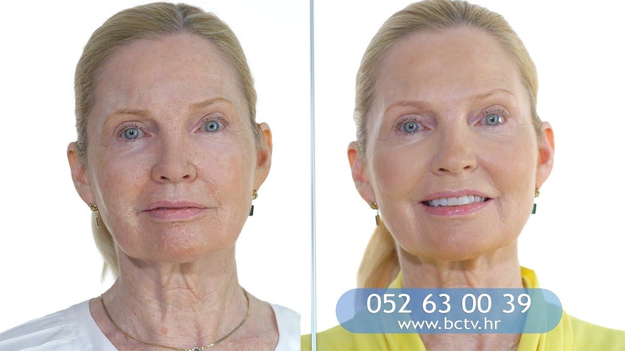 Helix Derma Spray | BCTV Hrvatska - 30s смотреть онлайн