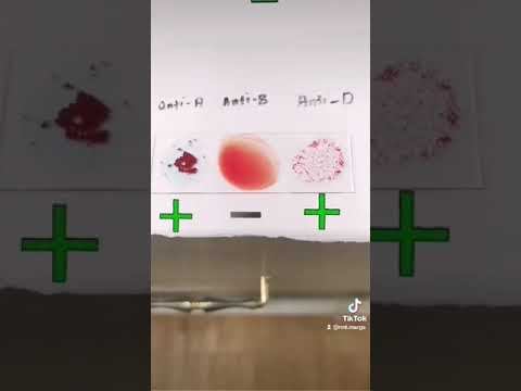 Did you get the blood group/blood type right? #laboratory #medtechstudent #bloodtyping #cls #mls смотреть онлайн