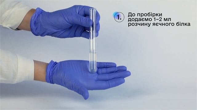 Якісні кольорові реакції білків — ксантопротеїнова реакція. Хімія 10 клас смотреть онлайн