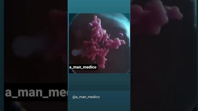 cell division-Mitosis , #medicalstudent #medical ,#doctor ,#cell ,#celldivision #a-man-medicos смотреть онлайн