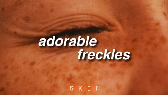 Adorable Freckles || Manifest Freckles