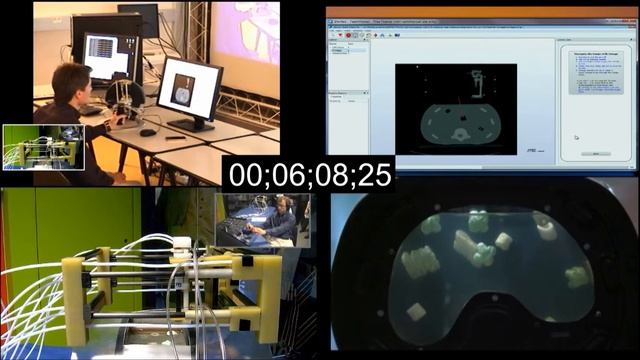 Public Demonstration: Teleoperated Navigation System for Needle Insertion смотреть онлайн