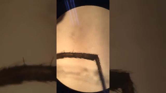 Araña al Microscopio смотреть онлайн