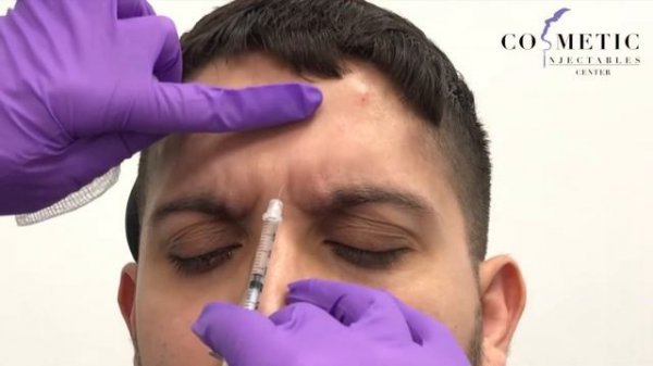 What's Brotox? Men That Get Botox Treatment