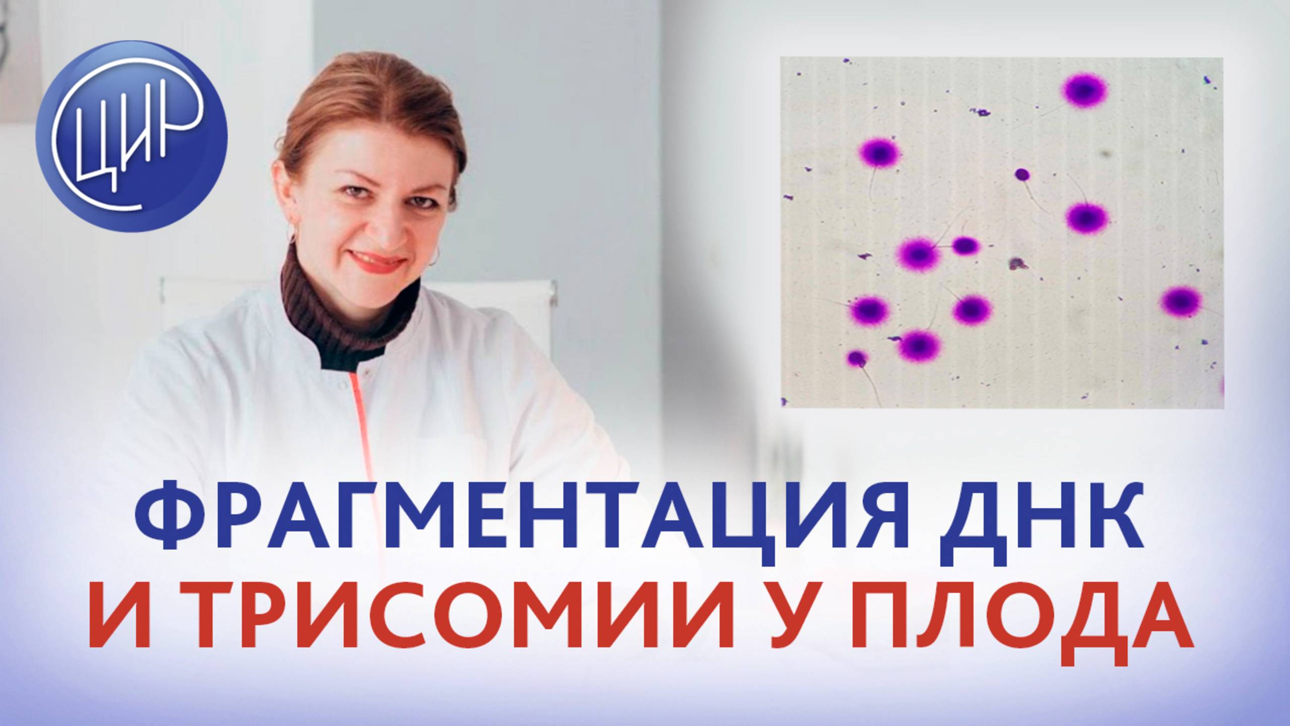 Фрагментация ДНК сперматозоидов и трисомии у эмбриона. Дементьева С.Н. смотреть онлайн