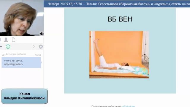 ACLON Варикозная болезнь и Флуревиты / Севостьянова Т (24.05.18) смотреть онлайн