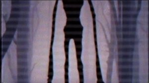 КАК СПАСТИСЬ от СИРЕНОГОЛОВОГО?