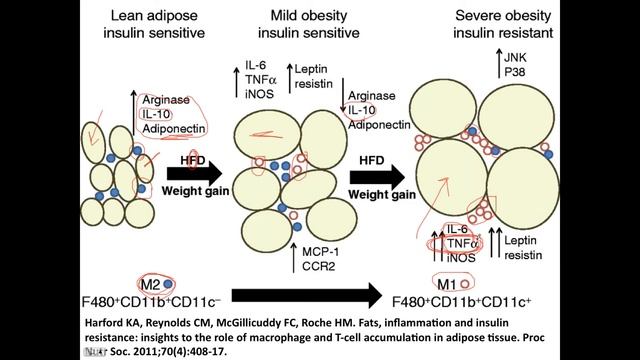 How body fat causes inflammation, chronic disease, and pain смотреть онлайн