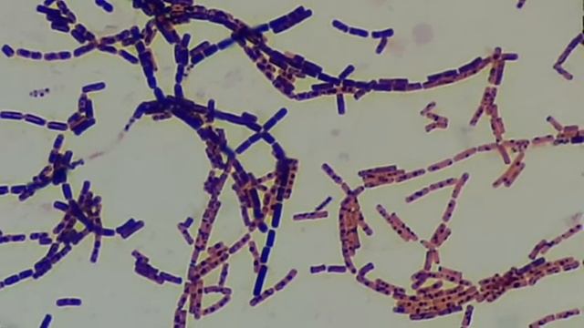 Bacillus endospores Microscopy, Bacillus colony morphology and Gram stain смотреть онлайн