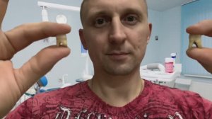 Удаление огромной кисты зуба. Удаление зуба с кистой