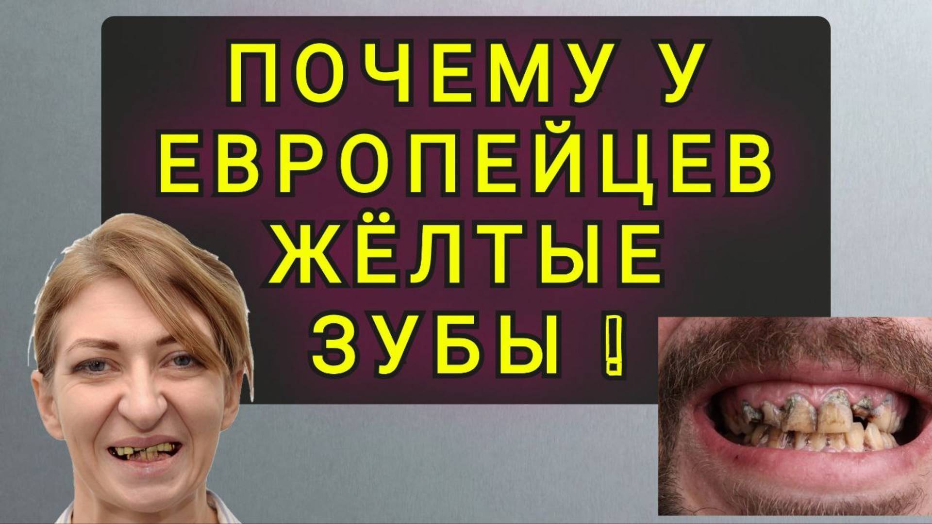 СТОМАТОЛОГИЯ ЕВРОПЫ ЭТО ЖЕСТЬ !! смотреть онлайн