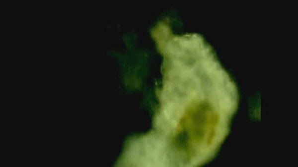 Amazing Animals the Water Bear