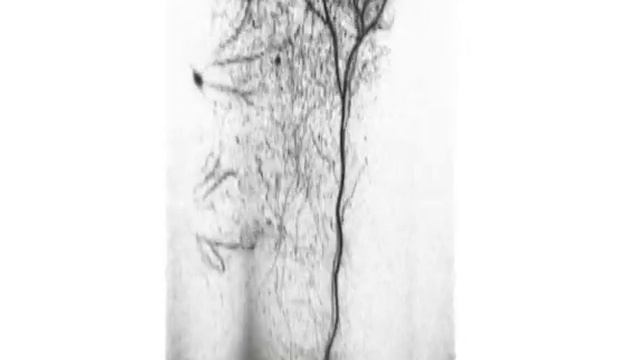 UCLA 2-Photon Microscopy - Layer 5 Pyramidal Neuron (3D) смотреть онлайн