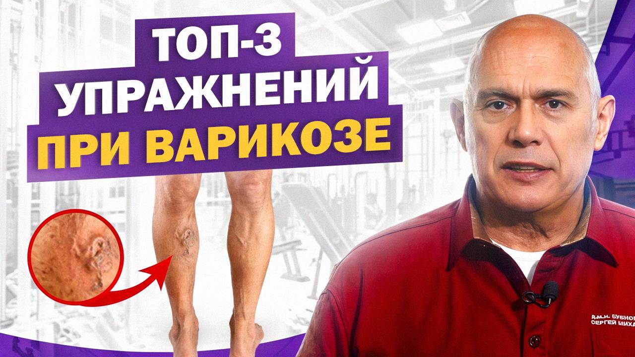 Лучшие упражнения при варикозе. Профилактика варикозного расширения вен у людей старше 40 лет смотреть онлайн