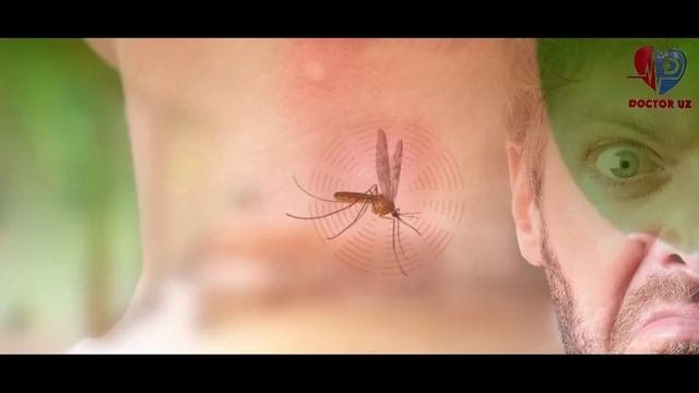 10 ТА ДАХШАТЛИ ХАШОРАТ ЧАҚИШИ БУНИ БИЛИШИНГИЗ КЕРАК смотреть онлайн