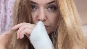 ВЛОГ Сломала руку! Перелом лучевой кости! Травматология 11-12.01.20