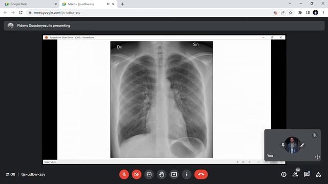 Radiology Saturday Course Part 2 смотреть онлайн