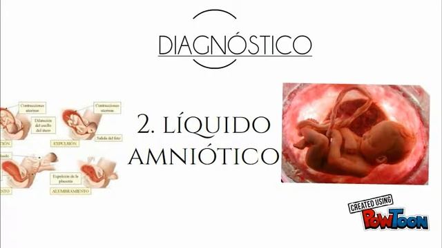 desprendimiento de placenta 1 смотреть онлайн