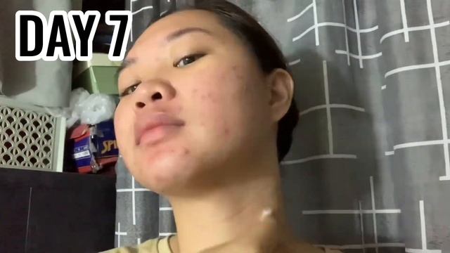 Brilliant Skin Rejuv Set (HONEST REVIEW) Day 1 - 30 смотреть онлайн