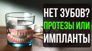 Нет ни одного зуба! Протезы или Импланты при полном отсутствии зубов?