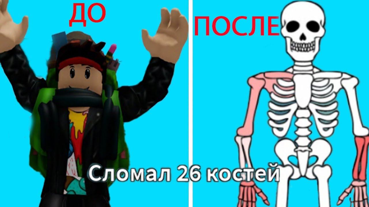 Сломал кучу костей и порвал связки в роблокс смотреть онлайн