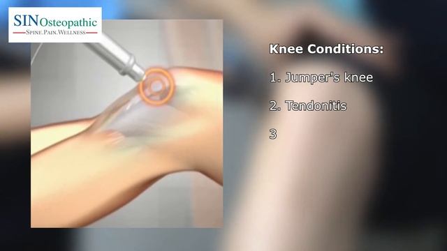 SIN Osteopathic - Shockwave Therapy 3 смотреть онлайн