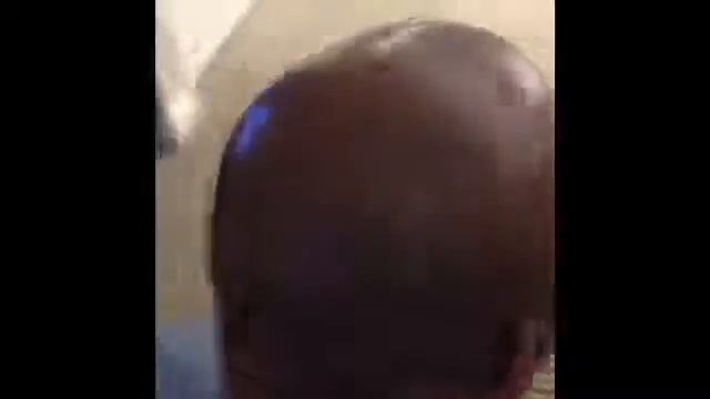 Before And After Hair Follicle Replication | Scalp Aesthetics