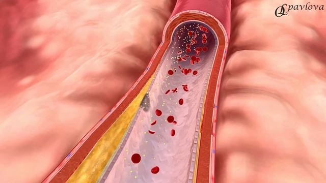 ❤️ КАК СЕЛЬДЕРЕЙ ПОМОЖЕТ ПОХУДЕТЬ И СНИЗИТЬ САХАР. Врач эндокринолог, диетолог Ольга Павлова. смотреть онлайн