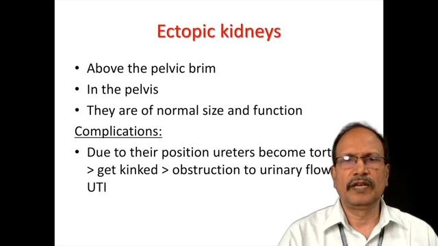Congenital Anomalies of Kidney смотреть онлайн