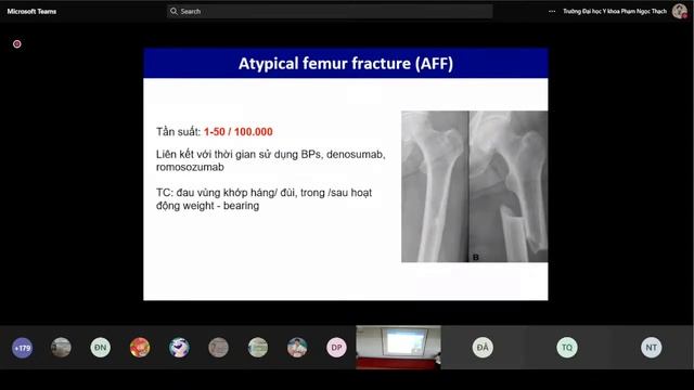 131022 - Nội - Điều Trị Thoái Hoá Khớp - Điều Trị Loãng Xương