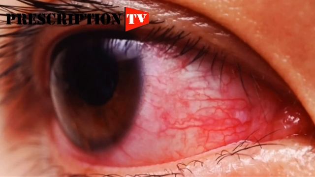 চোখ দেখে জানা যাবে শরীরের ৪টি মারাত্মক সমস্যা! EYES CAN TELL YOUR PHYSICAL PROBLEM смотреть онлайн