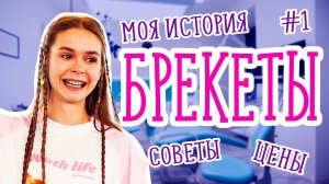 БРЕКЕТЫ – МОЯ ИСТОРИЯ. ГАЙД СО ВСЕМИ ЭТАПАМИ И ЦЕНАМИ ДЛЯ БУДУЩИХ БРЕКЕТОНОСЦЕВ.