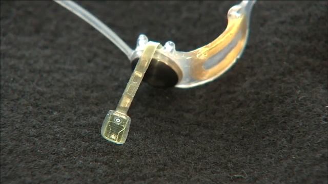 USC-developed retinal implant gives new vision to blind patient смотреть онлайн