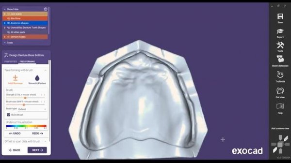 Designing Stunning Dentures On Exocad | EVIDENT Lab-To-Lab Education Series (Ep 85)