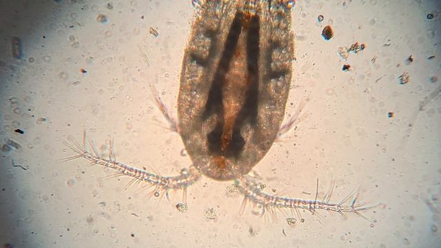 Cyclops a Small Crustacean I Use as a Live Fish Food смотреть онлайн