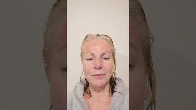 Skin precancer story, using efudex, video 3 смотреть онлайн