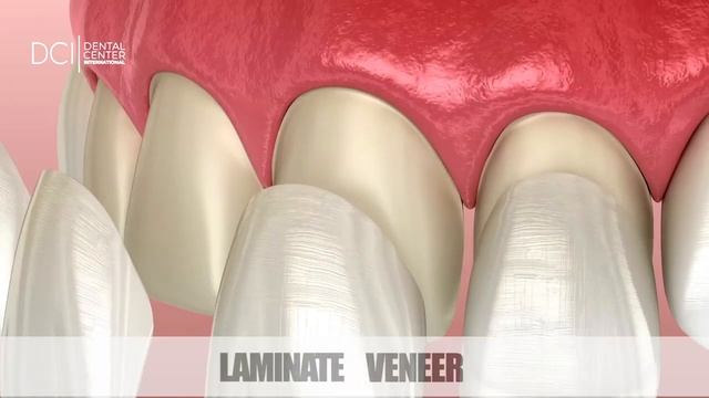 DCI Dental Clinic Turkey