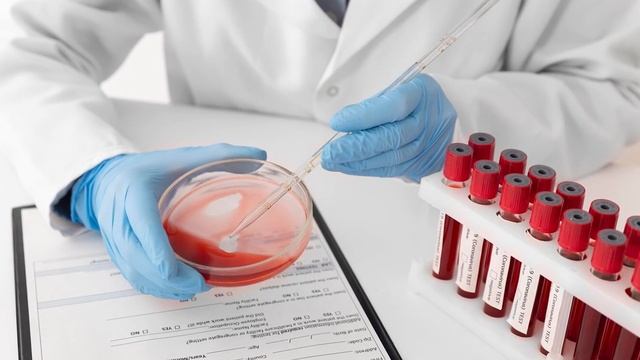 Лікувальні властивості цибулі смотреть онлайн