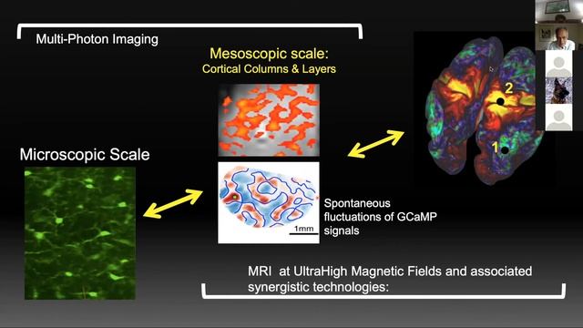 Kamil Ugurbil: High Resolution Neuroimaging: Accomplishments and Prospects