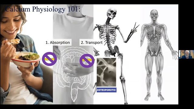 Healthy Bones Matter смотреть онлайн